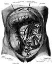 musculophrenic artery - an artery that supplies the abdomen and intercostal muscles