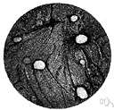 Wilson's disease - a rare inherited disorder of copper metabolism