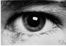 crystalline lens - biconvex transparent body situated behind the iris in the eye