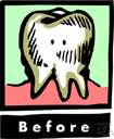 abscessed tooth