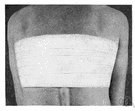 adhesive plaster - adhesive tape used in dressing wounds