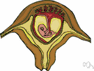 cesarian section - the delivery of a fetus by surgical incision through the abdominal wall and uterus (from the belief that Julius Caesar was born that way)