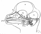 Meckel's diverticulum - a congenital diverticulum in the ileum resulting from incomplete closure of the yolk sac