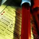 alpha globulin - a globulin in blood plasma or serum that is alkaline and has great electrophoretic mobility