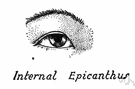 epicanthus - a vertical fold of skin over the nasal canthus