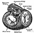 valvular heart disease - heart disease caused by stenosis of the cardiac valves and obstructed blood flow or caused by degeneration and blood regurgitation