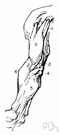 teres muscle - either of two muscles in the shoulder region that move the shoulders and arms