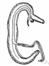 schistosomiasis - an infestation with or a resulting infection caused by a parasite of the genus Schistosoma