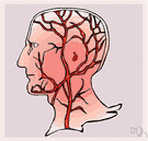 carotid artery - either of two major arteries of the neck and head