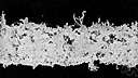 alder blight - a disease of alders caused by the woolly alder aphid (a plant louse)