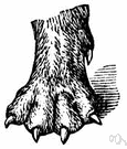 pes planus - a foot afflicted with a fallen arch