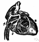coronary artery - the artery that branches from the aorta to supply blood to the heart