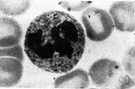 white blood cell - blood cells that engulf and digest bacteria and fungi