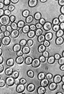 Moniliales - order of imperfect fungi lacking conidiophores of having conidiophores that are superficial and not enclosed in a pycnidium