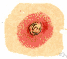 herpes - viral diseases causing eruptions of the skin or mucous membrane