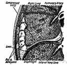 cavum pleurae перевод с латыни