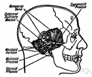 mastoiditis - inflammation of the mastoid