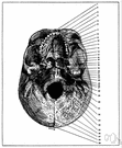 vena palatina - a vein that drains the region of the palate and empties into the facial vein