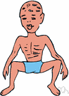 malnourished - not being provided with adequate nourishment