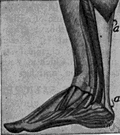 tendon of Achilles - a large tendon that runs from the heel to the calf