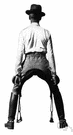 bow leg - outward curvature of the legs