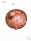 mammee tree - tropical American tree having edible fruit with a leathery rind