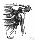 Abarticulation - dislocation of a joint