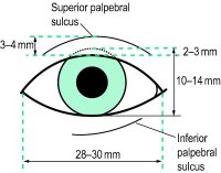 Fig. A16 Average dimensions of the normal palpebral aperture of a Caucasian eye