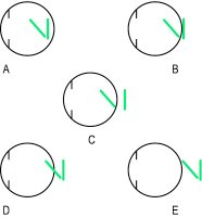 Fig. A22 Clinical types of astigmatism (A, compound myopic; B, simple myopic; C, mixed; D, simple hyperopic; E, compound hyperopic)