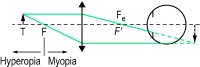 Fig. O3 Optical principle of the Badal optometer ( F , F ′, first and second principal focus of the lens; F e , anterior focal point of the eye; T, target)