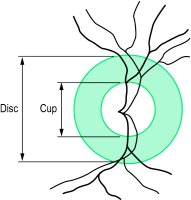 Fig. R1 Diagram of the physiological cup with a cup-disc ratio of 0