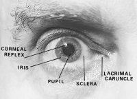 Fig. R5 Frontal view of the right eye