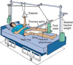 Balanced suspension | definition of balanced suspension by Medical ...