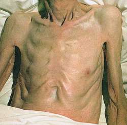 Endocrine 1 Nur 2 on emaze