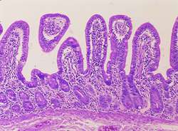 Jejunum | definition of jejunum by Medical dictionary