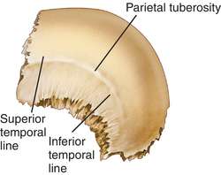 left parietal bone
