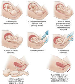 Labor definition of labor by Medical dictionary