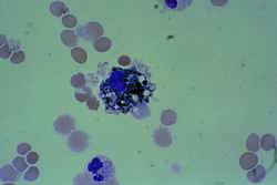 Macrophage Definition Of Macrophage By Medical Dictionary