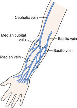 Intravenous  definition of intravenous by Medical dictionary