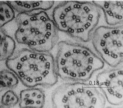 Electron micrograph of cilia showing 9 + 2 pattern of axoneme