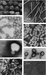 Electron micrographs of highly purified preparations of some viruses