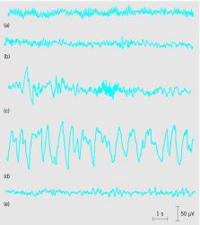 Human EEG associated with different stages of sleep and wakefulness