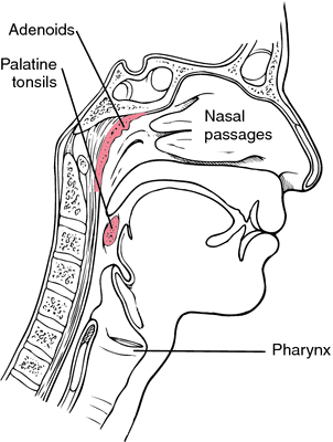 Adenoid Definition Of Adenoid By Medical Dictionary