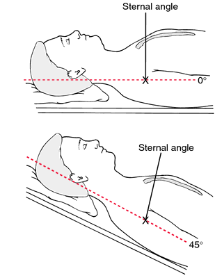 Sagittal Plane Frontal Axis