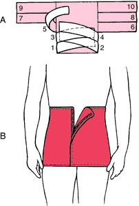 Binders  definition of binders by Medical dictionary