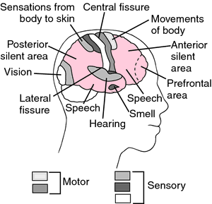 Brain tumor  definition of brain tumor by Medical dictionary