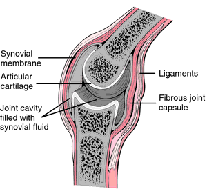 capsule articulare artroza deformată a genunchiului ce este