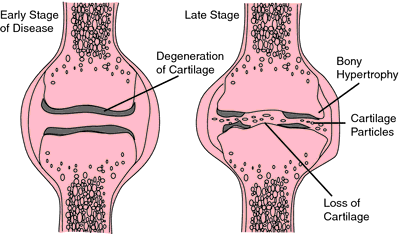 articular meaning anatomy