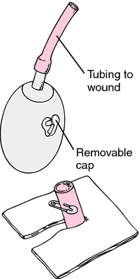 Jackson-Pratt Drain Care Instructions