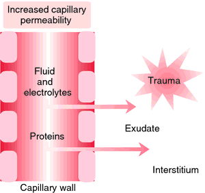 Pitted keratolysis - Wikipedia